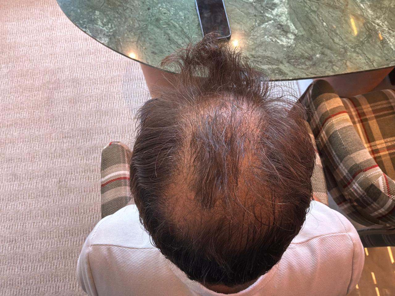 Antes — Vista superior, registro adicional enviado pelo Dr. Luís Paulo.